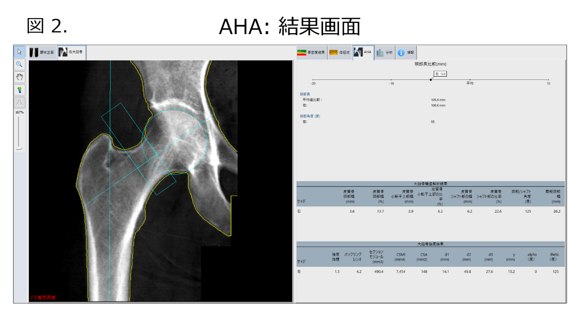 Technical Tips_AHA02.png